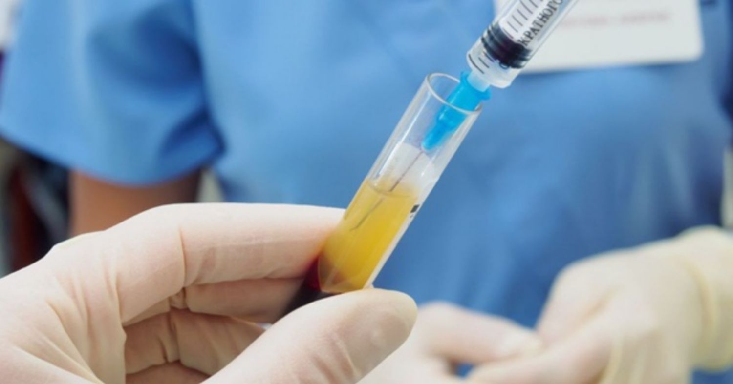 Tiêm PRP trong điều trị rối loạn cương dương: Hiệu quả và tác dụng phụ