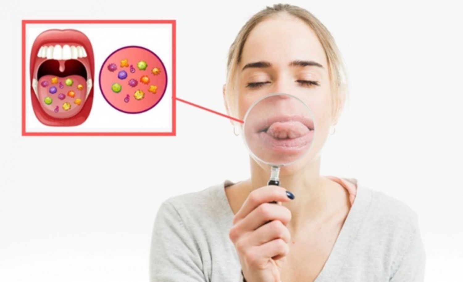 Những bệnh xã hội có thể lây qua nụ hôn