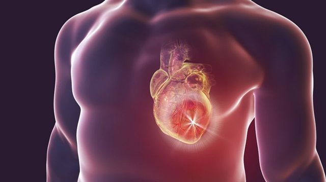 Suy tim sung huyết là gì và điều trị ra sao?
