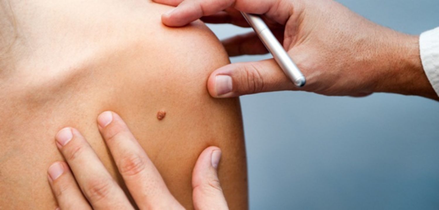 Các vấn đề về da ở người nhiễm HIV