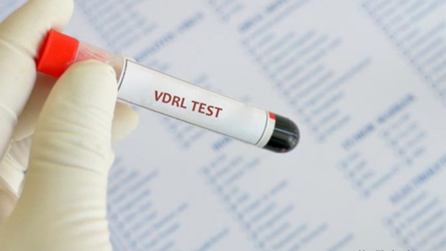 VDRL Test1