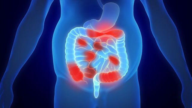 Viêm ruột: Nguyên nhân, triệu chứng và cách điều trị