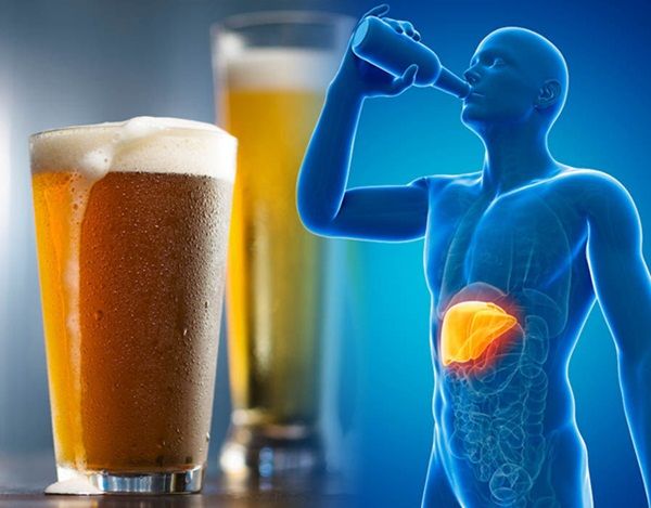 Cách điều trị xơ gan do rượu