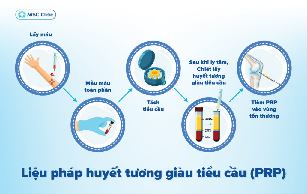 Phương pháp này không gây đau nhiều, không để lại sẹo và không cần thời gian phục hồi dài như phẫu thuật.